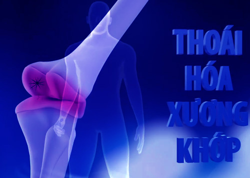 cốt khí long trị bệnh viêm xương khớp