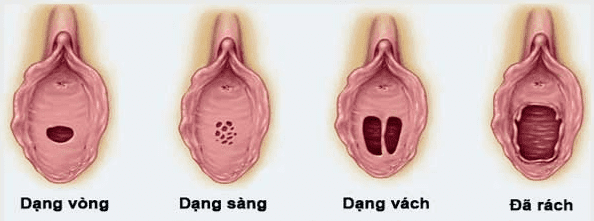 hinh-anh-mang-trinh-o-con-gai1